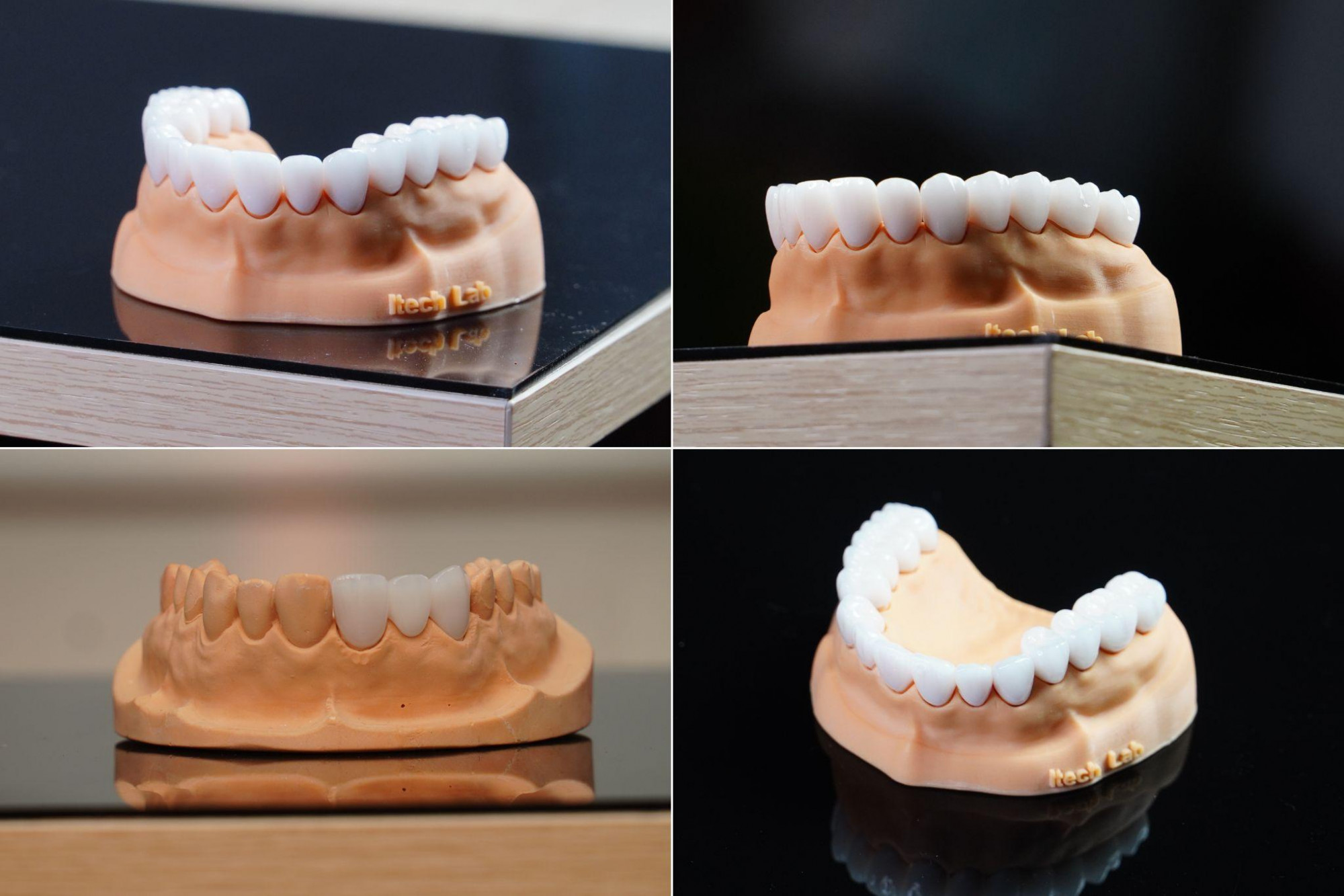 Mẫu răng sứ tại ph&ograve;ng chế t&aacute;c răng sứ của nha khoa I-Dent DiamondTech