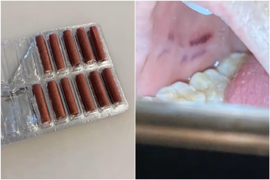 Tr&ecirc;n mạng x&atilde; hội, nhiều người thừa nhận phong ph&aacute;o tr&ocirc;ng rất giống kẹo