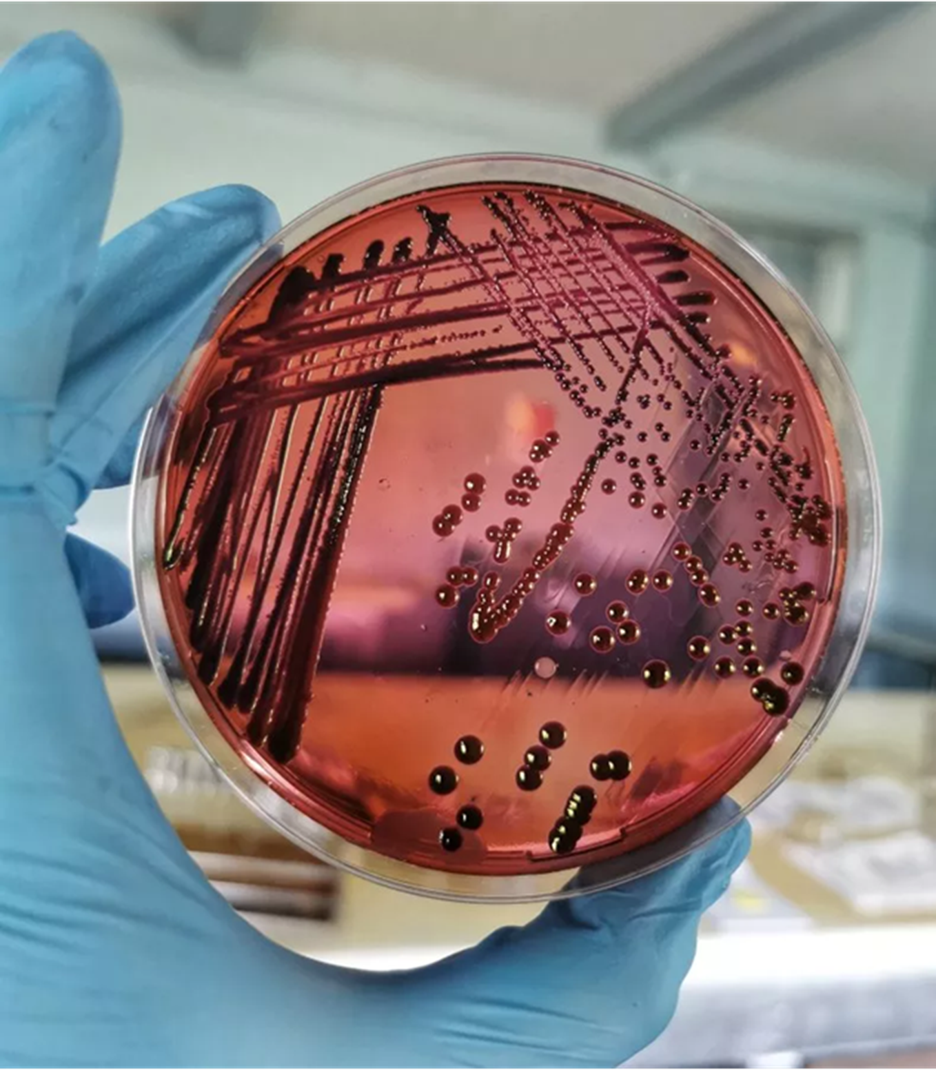 Vi khuẩn E.coli ph&aacute;t triển tr&ecirc;n đĩa nghi&ecirc;n cứu trong ph&ograve;ng th&iacute; nghiệm vi sinh &mdash; Ảnh: Getty Images