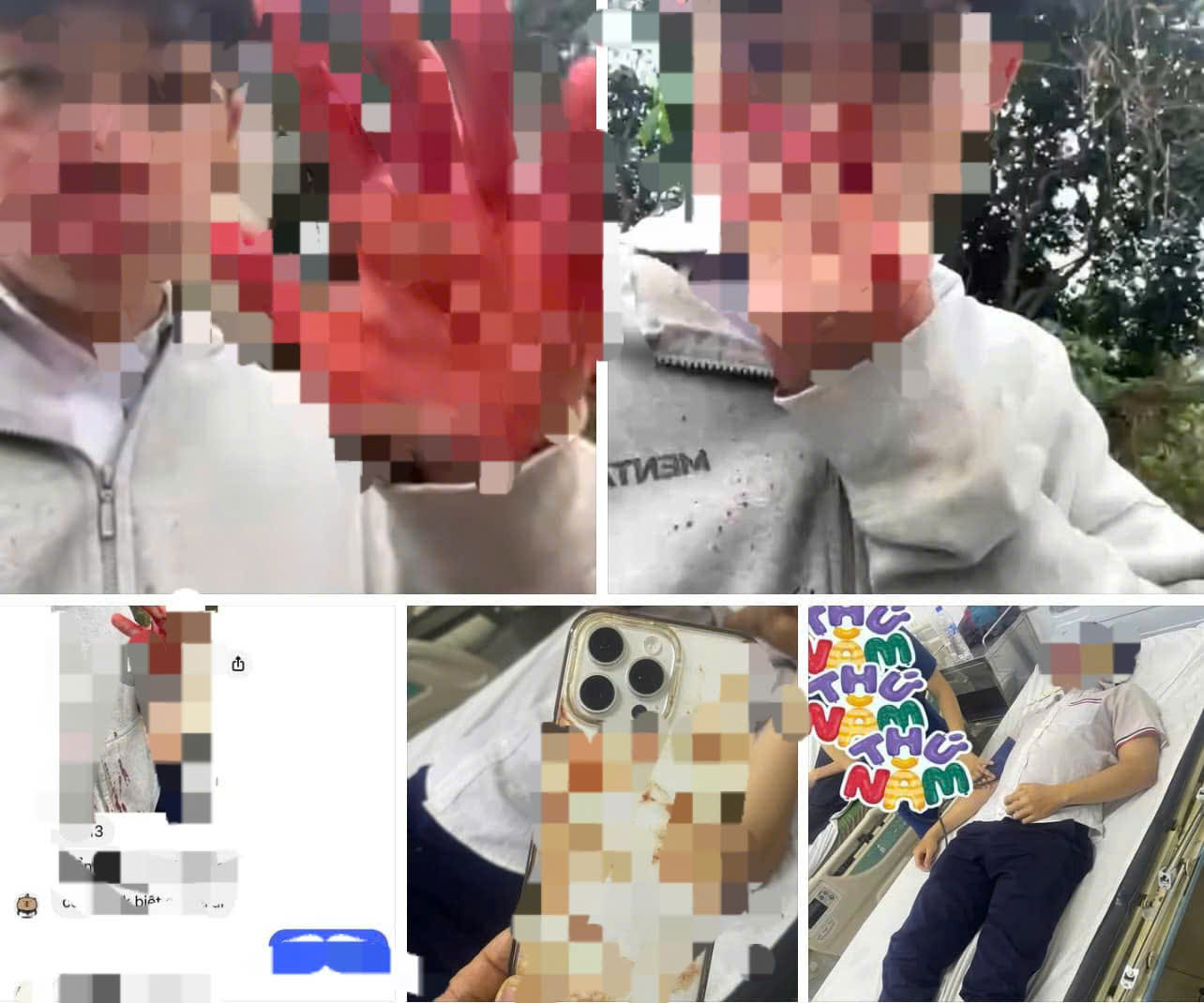 H&igrave;nh ảnh được gia đ&igrave;nh nam sinh đăng tải l&ecirc;n mạng.