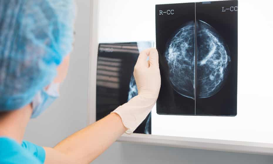 Cứ mỗi ph&uacute;t lại c&oacute; th&ecirc;m 1 phụ nữ được chẩn đo&aacute;n mắc ung thư v&uacute; - Ảnh: Getty Image