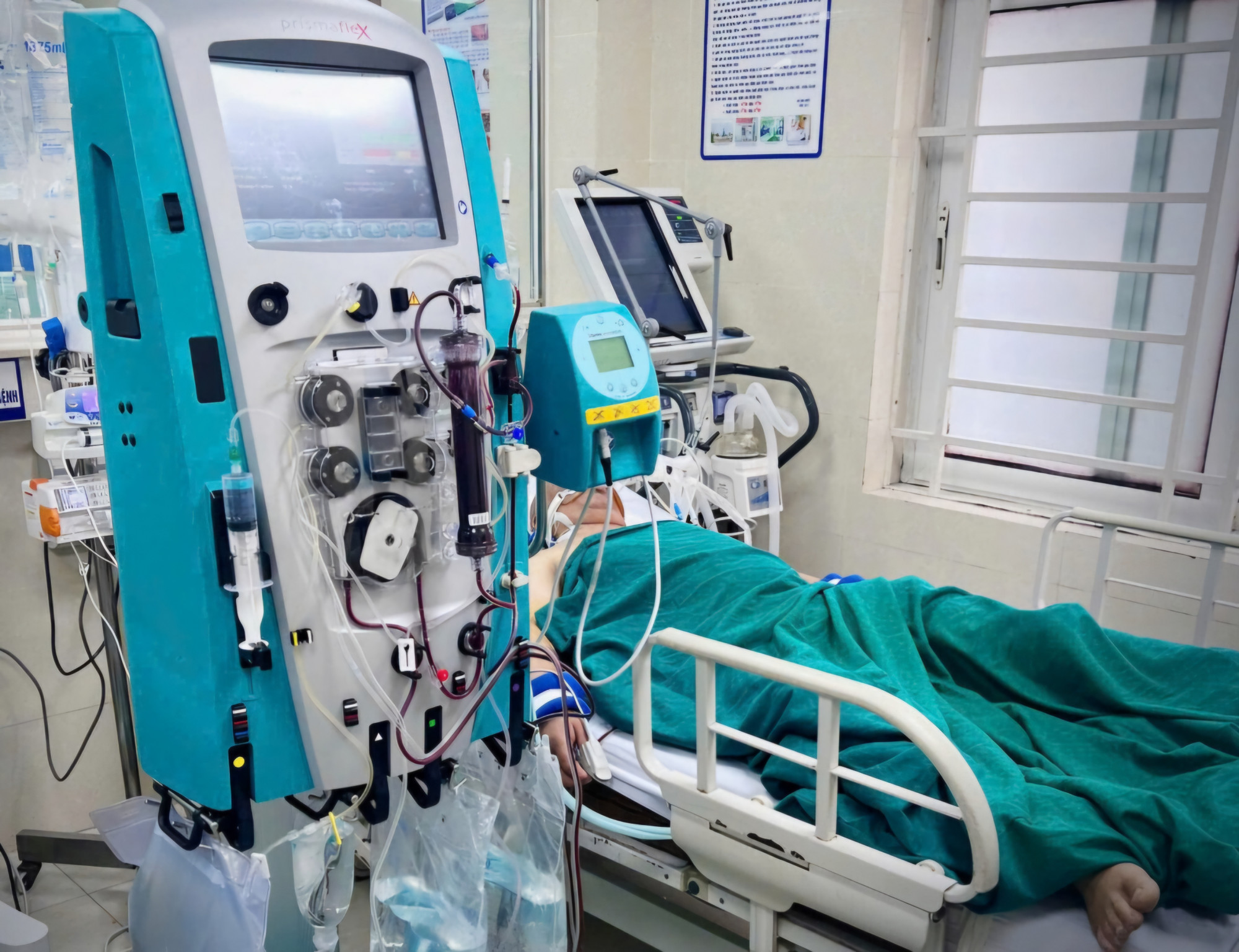Người đ&agrave;n &ocirc;ng h&ocirc;n m&ecirc;, suy h&ocirc; hấp v&igrave; ngộ độc rượu cồn Methanol - ảnh: BVCC