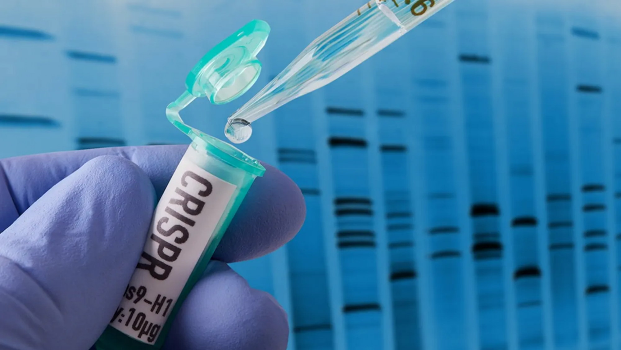 C&aacute;c nh&agrave; khoa học từ bang California sử dụng c&ocirc;ng nghệ chỉnh sửa gen CRISPR, để &ldquo;thiết kế&rdquo; c&aacute;c tế b&agrave;o miễn dịch c&oacute; khả năng chữa bệnh Alzheimer &mdash; Ảnh: iStock