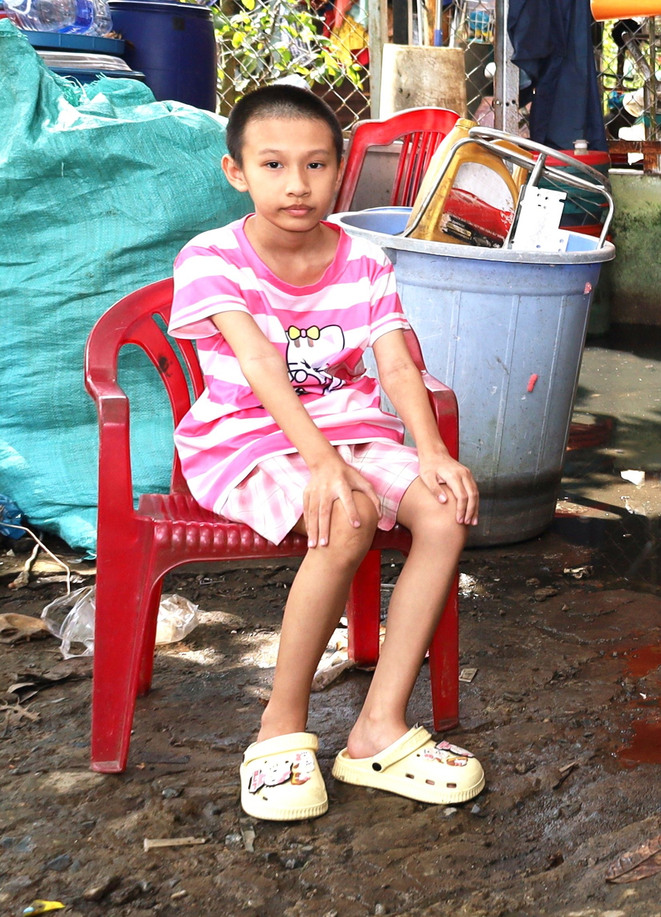 B&eacute; Phạm Kim Thy đang bị khối u &aacute;c t&iacute;nh