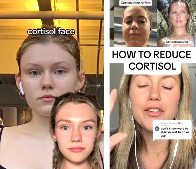 Những b&agrave;i đăng về c&aacute;ch xử l&yacute; gương mặt sưng ph&ugrave;, mệt mỏi do mức cortisol cao tr&ecirc;n mạng x&atilde; hội - Ảnh: tiktok.com/@itsbrookeelle; tiktok.com/@nutritionistkristen 