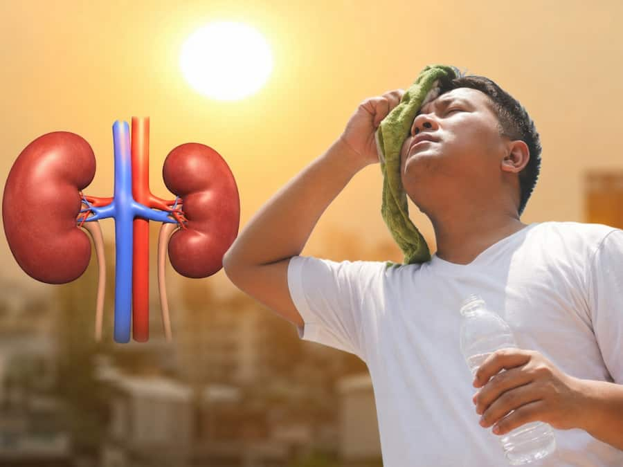 co-the-thieu-nuoc-giua-nang-nong-than-co-the-chiu-ton-thuong-nghiem-trong.png