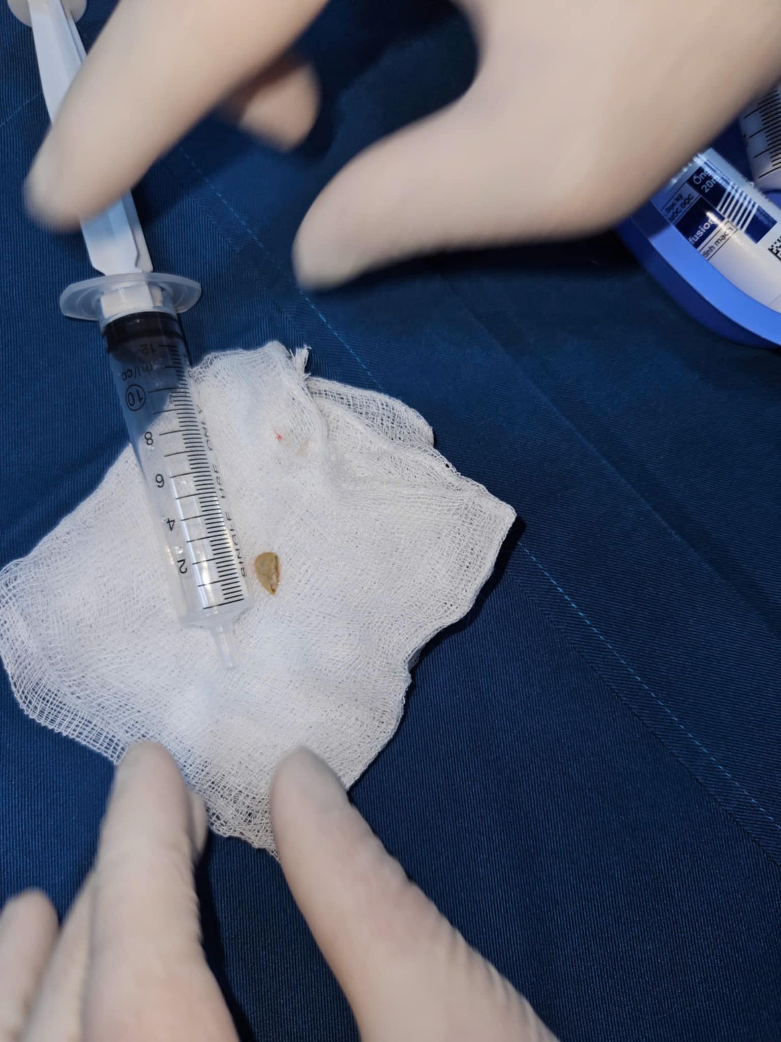 Bé gái 1 tuổi