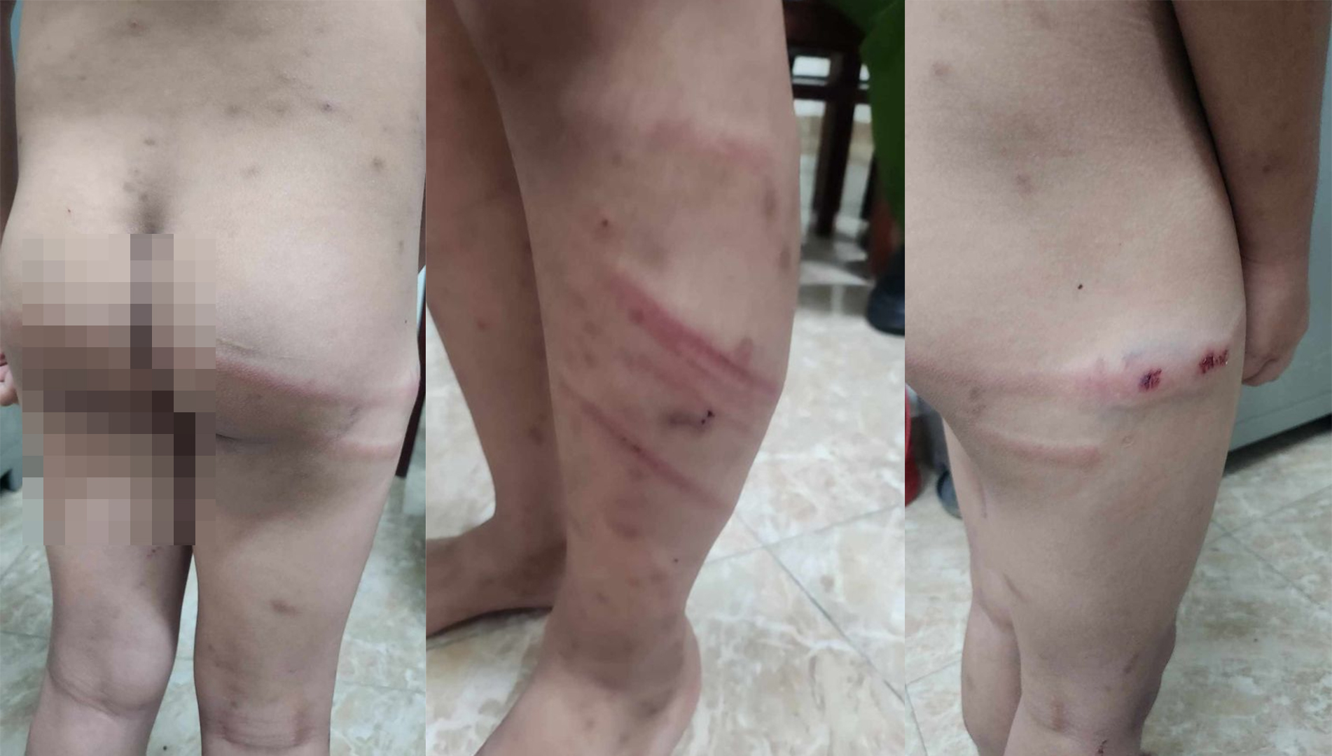 Lời khai người mẹ vụ cùng bạn trai bạo hành con trai 11 tuổi.jpg