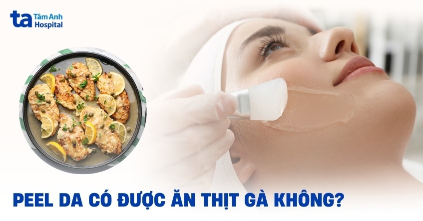 Peel da có ăn được thịt gà không?