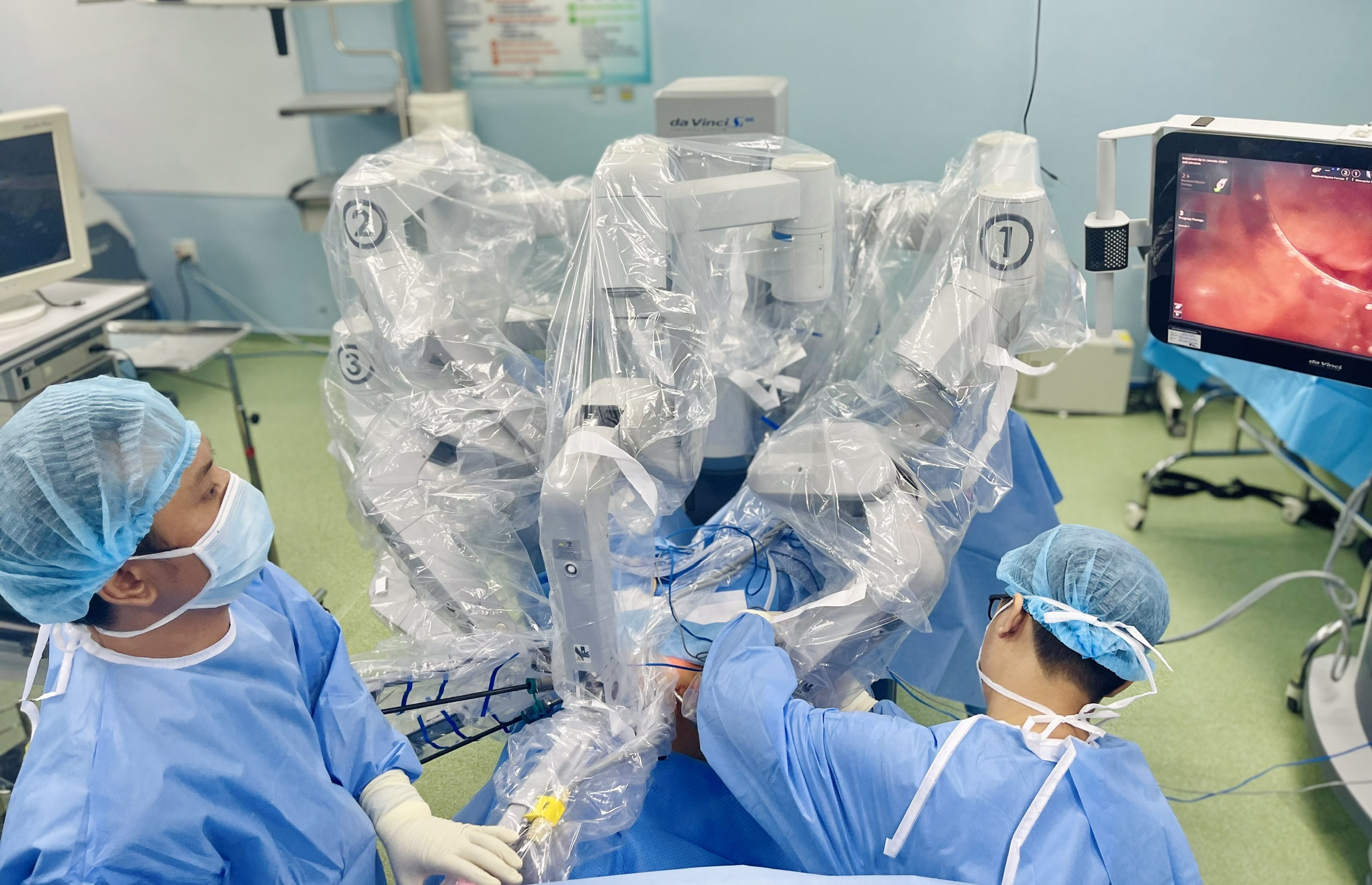 phau-thuat-robot2.jpg