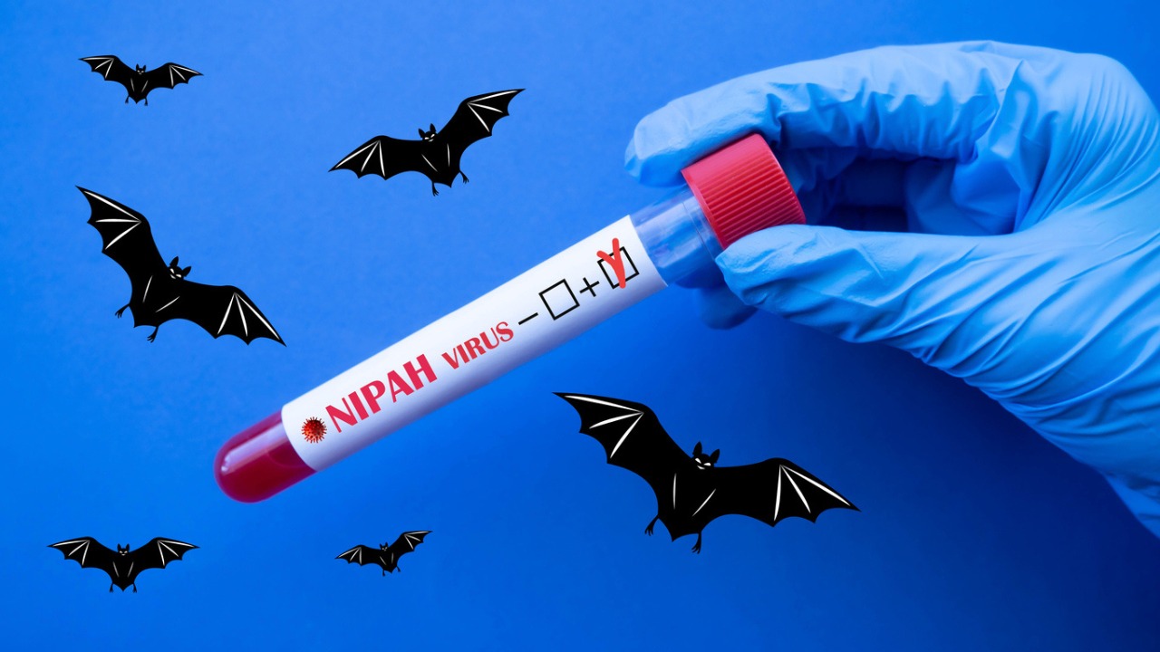 Những điều cần biết về virus Nipah và cách phòng tránh