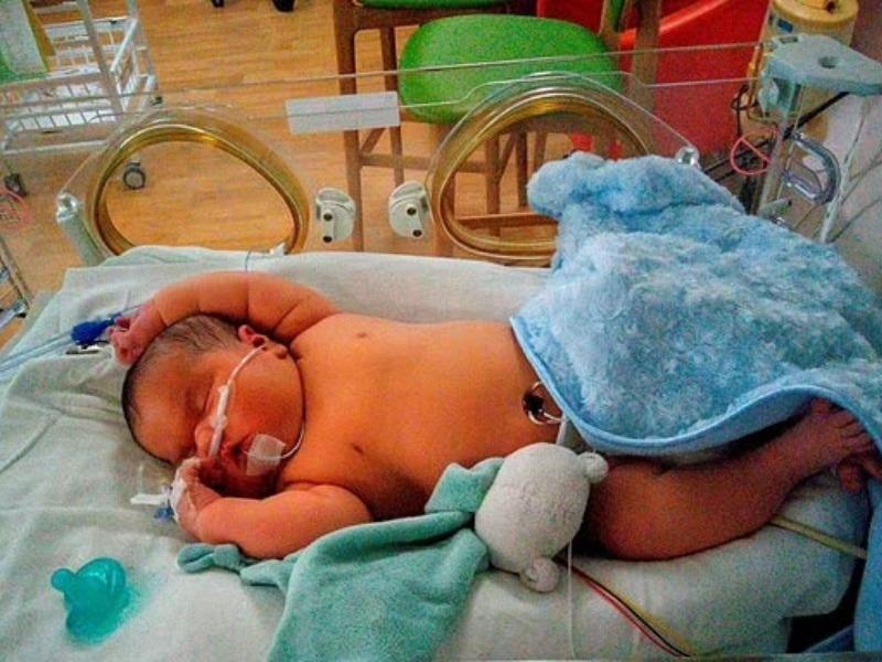 Choáng với bé sơ sinh nặng 6,7 kg