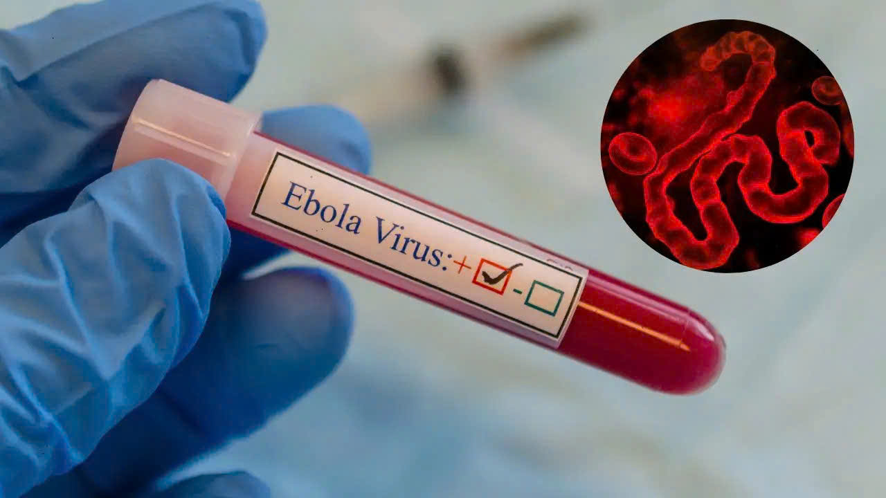 Bộ Y tế vừa phát công điện hỏa tốc về Ebola