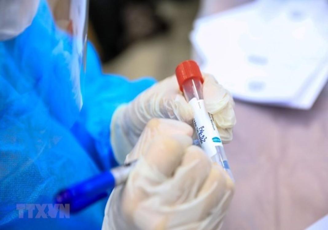 Vietnam’s Covid-19 tally surpasses 500,000