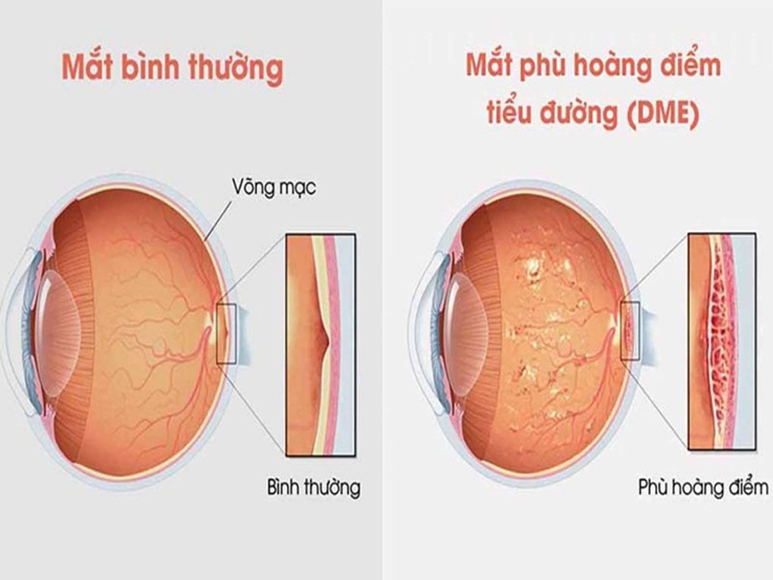 Tin tức sáng 18-6: Hôm nay, khởi công đường vành đai 3 TP.HCM - Ảnh 6.