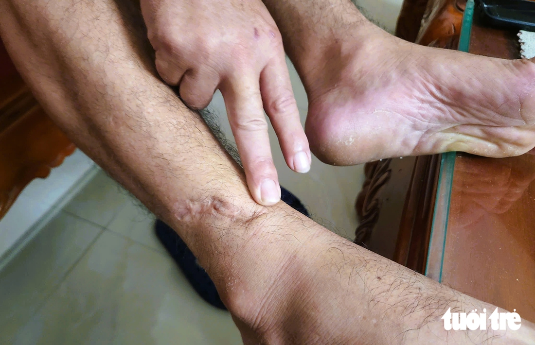 Phía sau những bước chân giữ rừng - Ảnh 5.