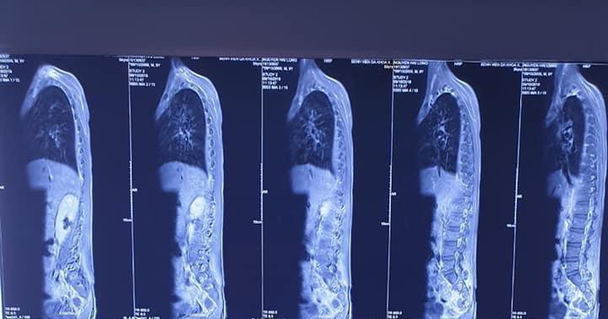 Cứu cháu bé 9 tuổi có thể nguy kịch chỉ vì một vết xước