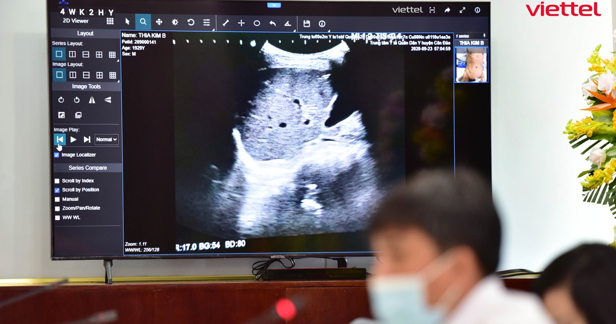 1.800 ca COVID-19 nặng được hội chẩn qua Telehealth