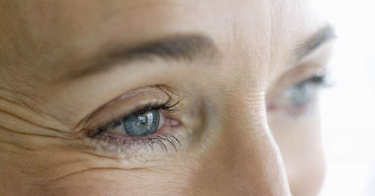 Vết chân chim là thứ không chị em nào thích, ngăn ngừa bằng cách nào? - Tuổi Trẻ Online