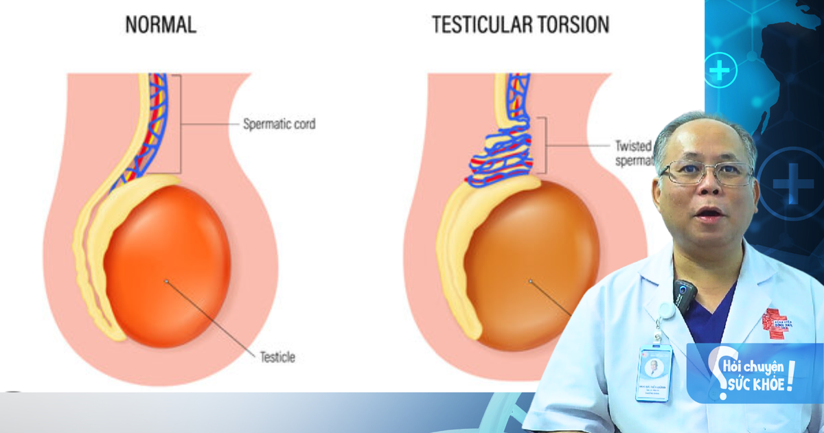 Xoắn dây tinh và thời gian vàng cấp cứu