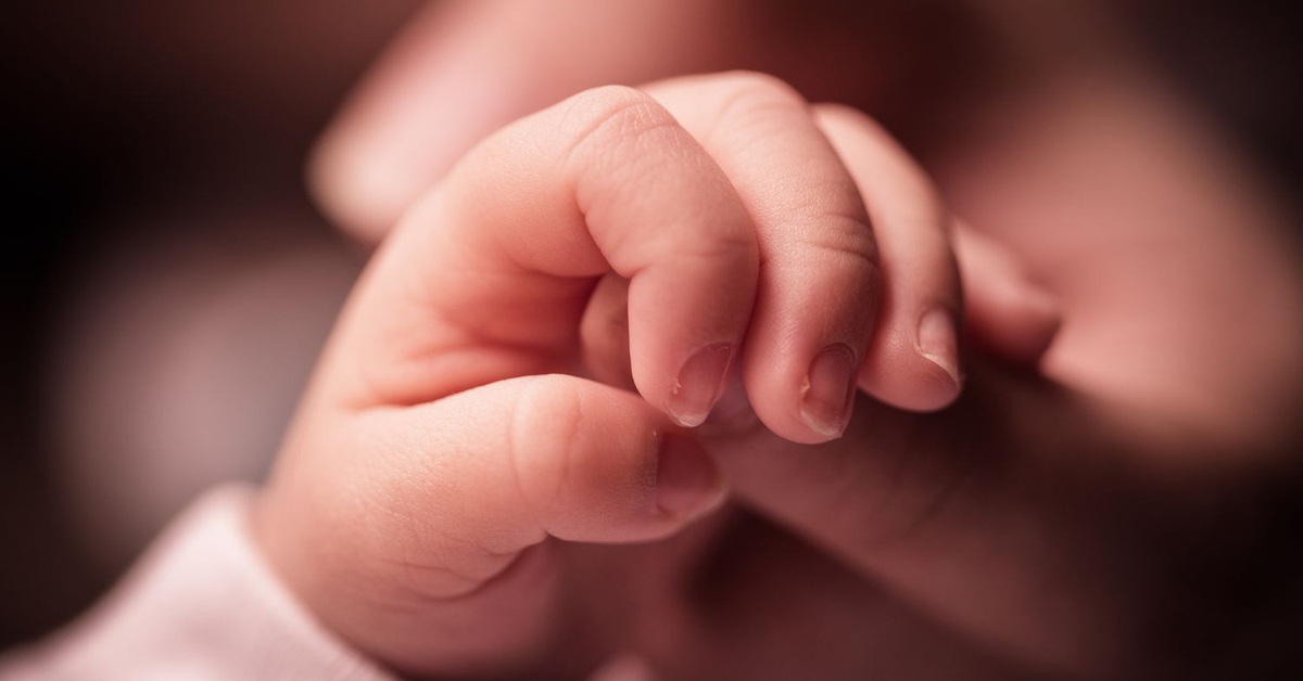 Em bé ở Hà Nội mắc hội chứng siêu nữ hiếm gặp, đó là gì?