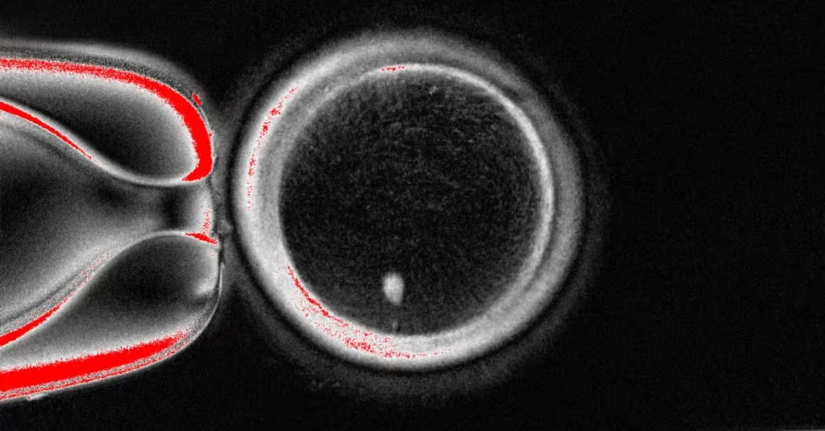 Các nhà khoa học dùng công nghệ nhân bản để hoán đổi DNA trong trứng người