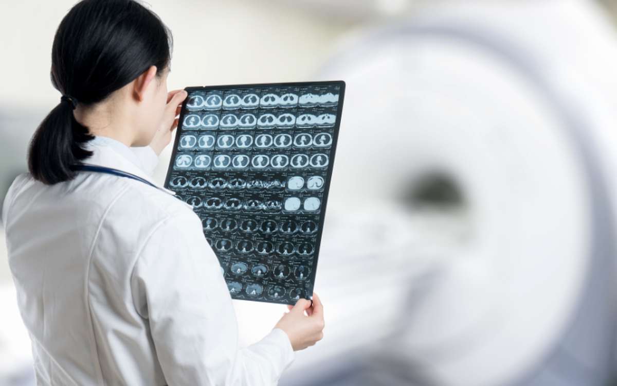 Não đàn ông 'teo' nhanh hơn phụ nữ