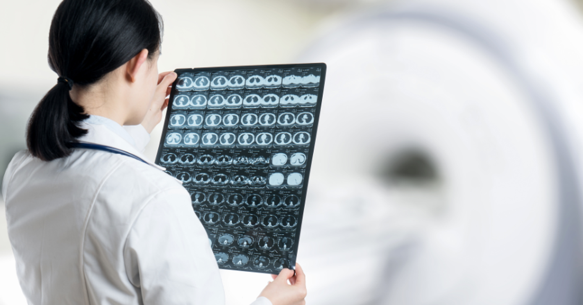 Não đàn ông 'teo' nhanh hơn phụ nữ
