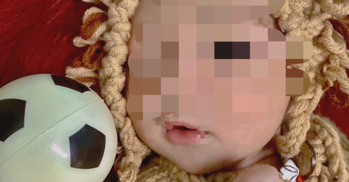 Trẻ sơ sinh 5 ngày tuổi bị thủng dạ dày vì mẹ cho ăn cơm