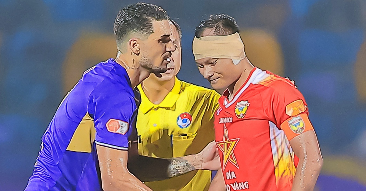 Trọng Hoàng bị Hoàng Hên giậm rách gần lìa tai trái