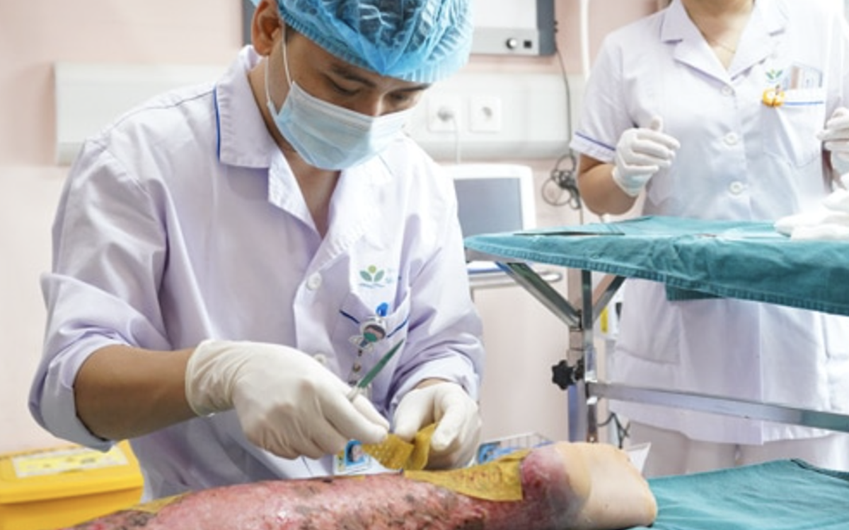 Tự làm thí nghiệm đốt cồn tại nhà, bé trai 12 tuổi bỏng nặng