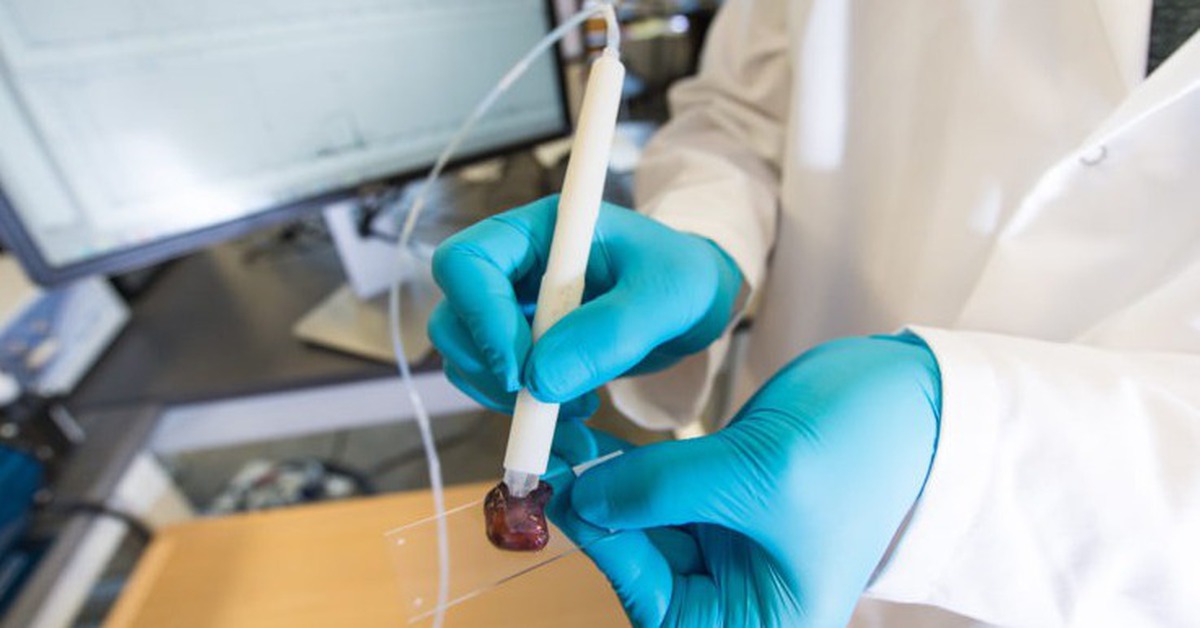 Thiết bị phát hiện được ung thư chỉ trong 10 giây