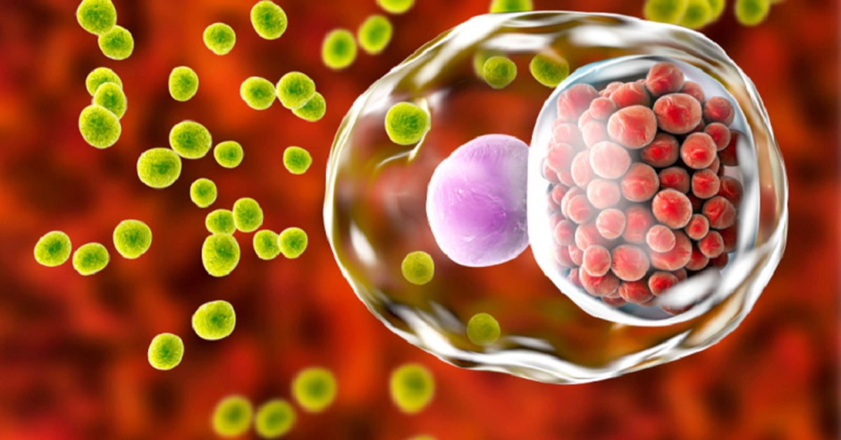 Quan hệ đồng giới không an toàn, nam thanh niên viêm họng do tác nhân hiếm gặp