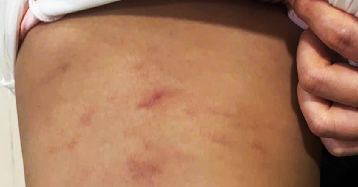 Công an vào cuộc vụ cô giáo đánh bé 2 tuổi ở Cà Mau