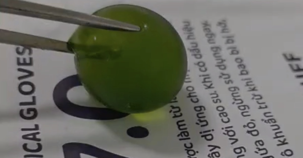 Nuốt phải hạt nở, bé 13 tháng tuổi nôn ói, tắc ruột