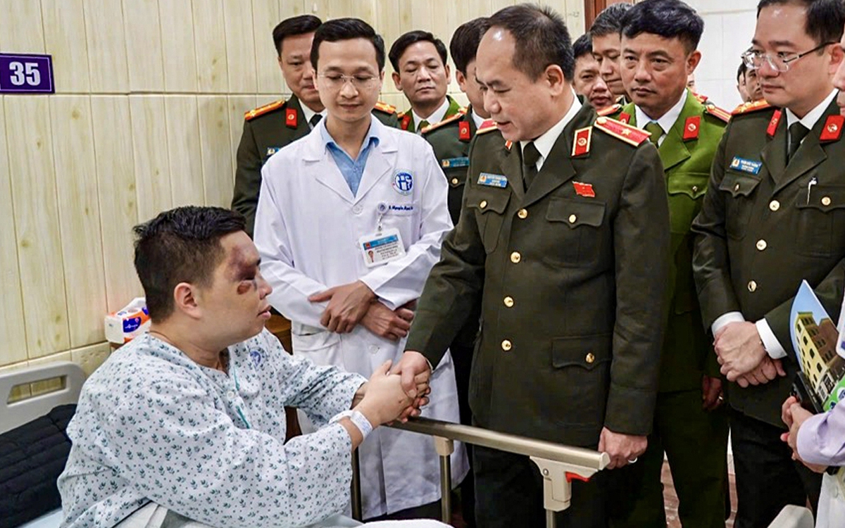 Giám đốc Công an Hà Nội thăm thiếu tá bị tài xế xe máy tông trực diện khi làm nhiệm vụ