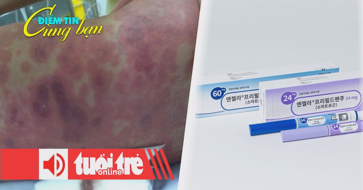 Điểm tin 8h: Dịch viêm não mô cầu ở Thái Bình; Tiêm hormone tăng chiều cao cho con