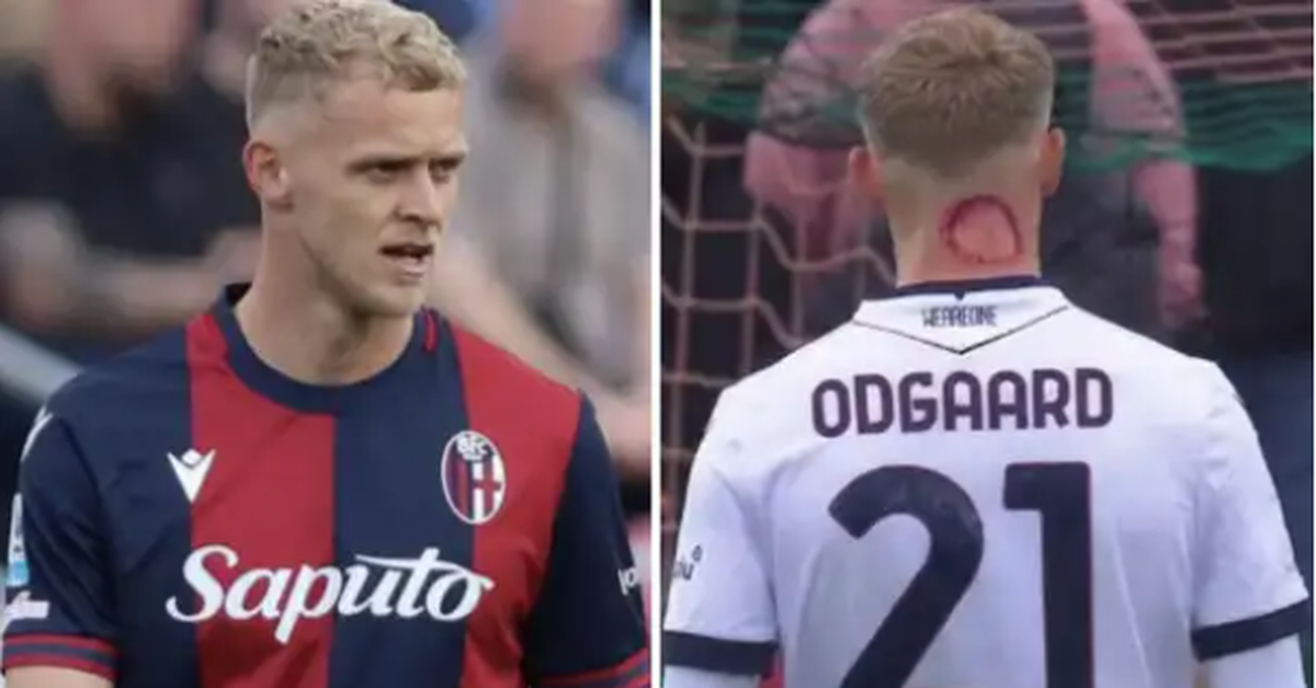 Ngôi sao Serie A bị nghi ngờ 'Zombie cắn' khi có vết đỏ kỳ lạ trên cổ