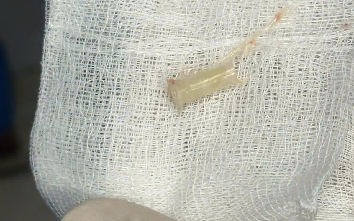 Nghe có tiếng kèn phát ra từ nhịp thở của cậu bé 7 tuổi, người mẹ đi tìm bệnh cho con