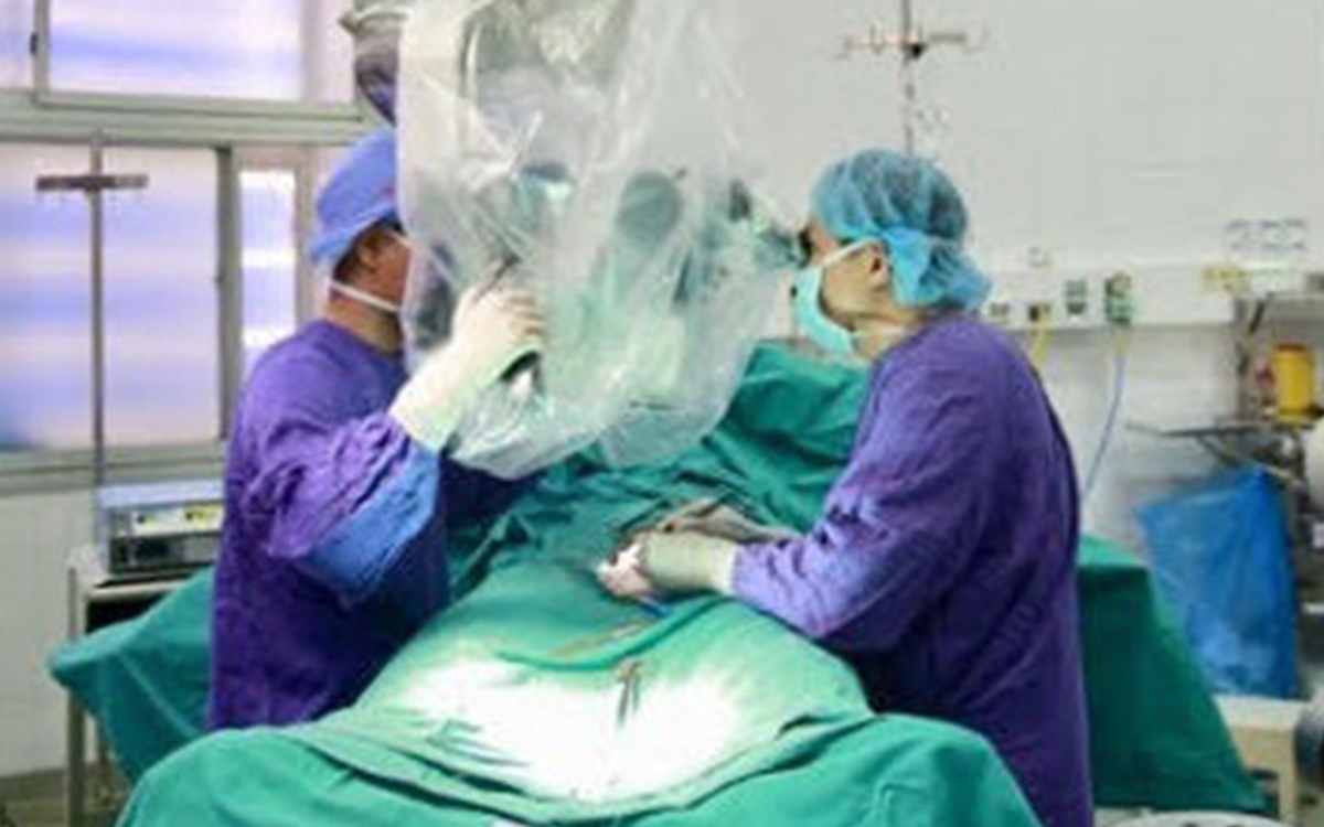 Giãn tĩnh mạch tinh: 'Sát thủ thầm lặng' gây vô sinh