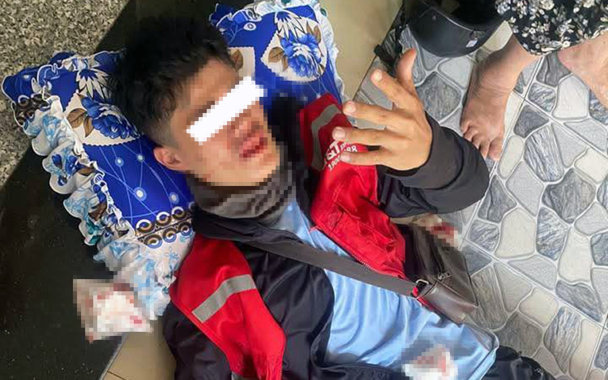 Nam shipper bị đuổi đánh vỡ mũi, sưng trán khi đi giao hàng
