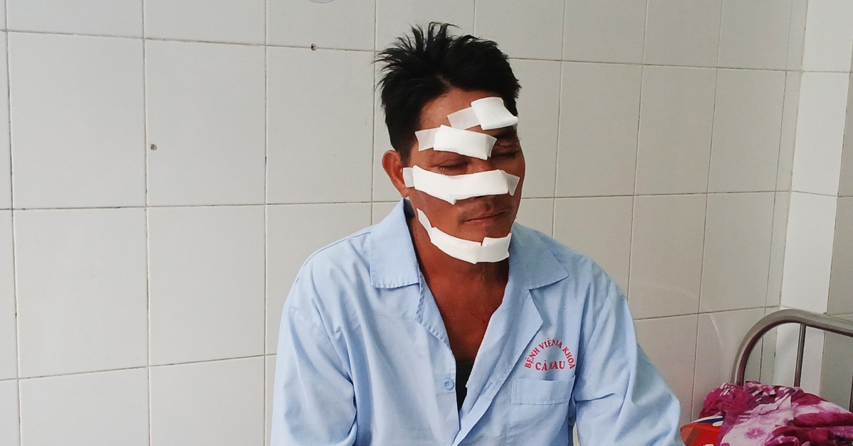 Máy bay nông nghiệp chém trúng đầu người chạy xe máy