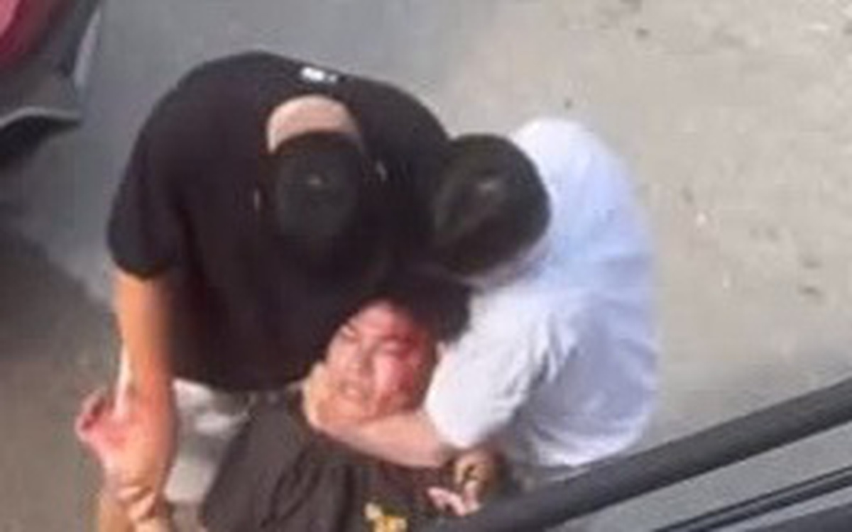 Vừa đánh người chảy máu đầu vừa hỏi 'có biết tao là ai không'