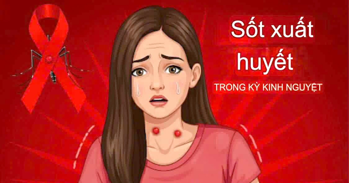 Cảnh giác sốt xuất huyết nhầm với chảy máu kinh nguyệt