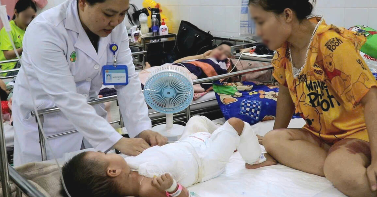 Bé trai 2 tuổi bỏng nặng, được cứu sống nhờ ghép da từ mẹ ruột