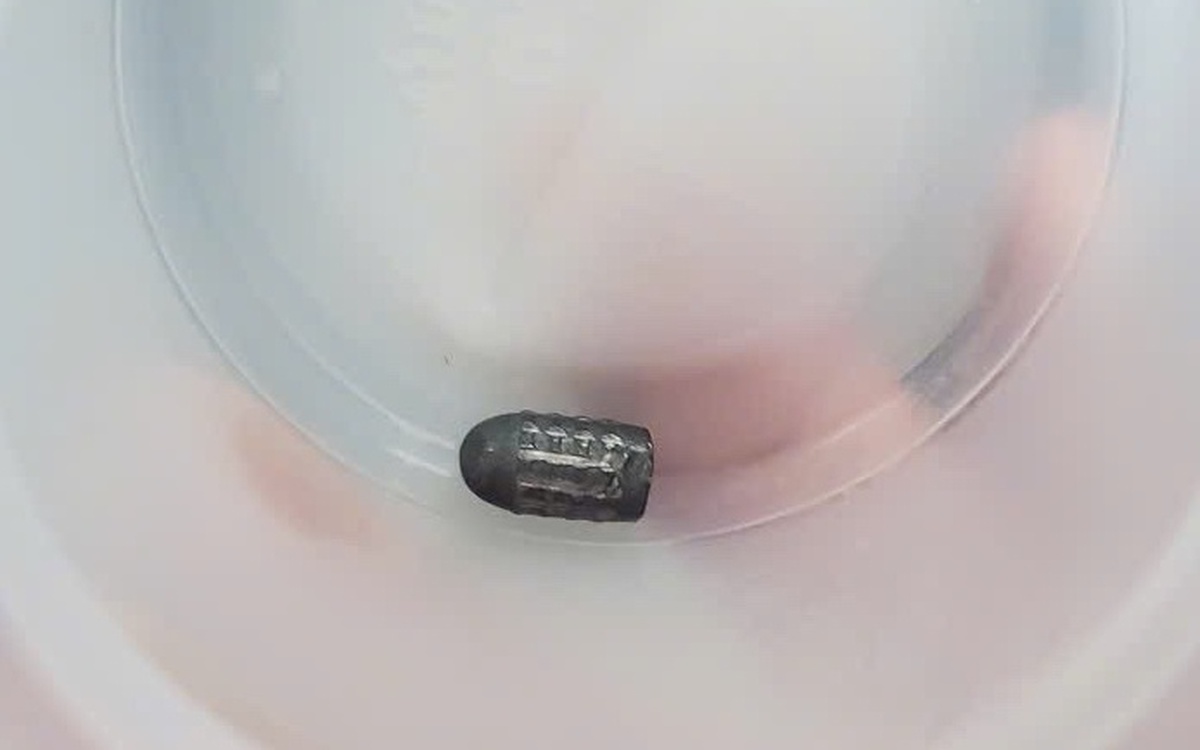 Žensko med delom na vrtu zadela krogla v glavo v Vietnamu