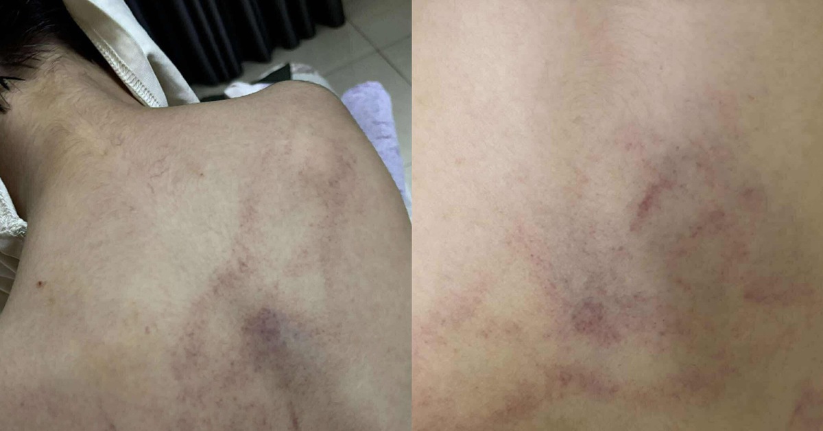 Gia đình tố cô giáo mầm non đánh, kéo lê, ném bé gái 4 tuổi vào tường
