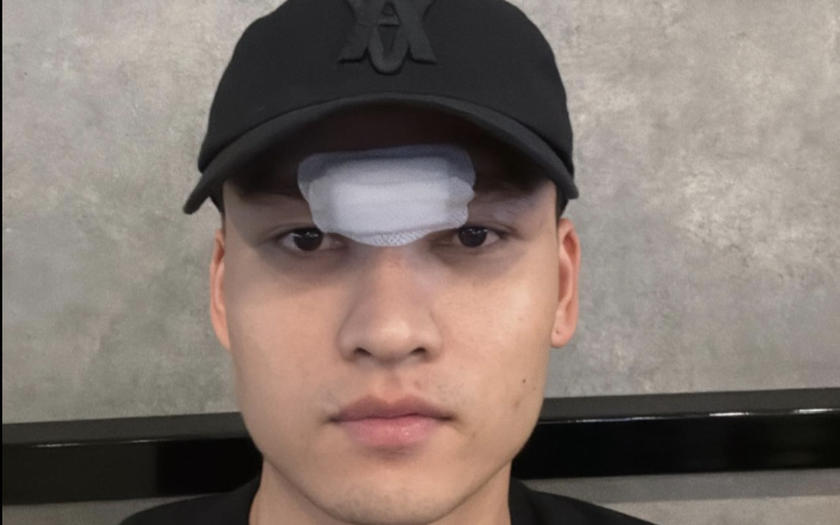 Bị sút thẳng mặt, Bùi Hoàng Việt Anh phải khâu 14 mũi