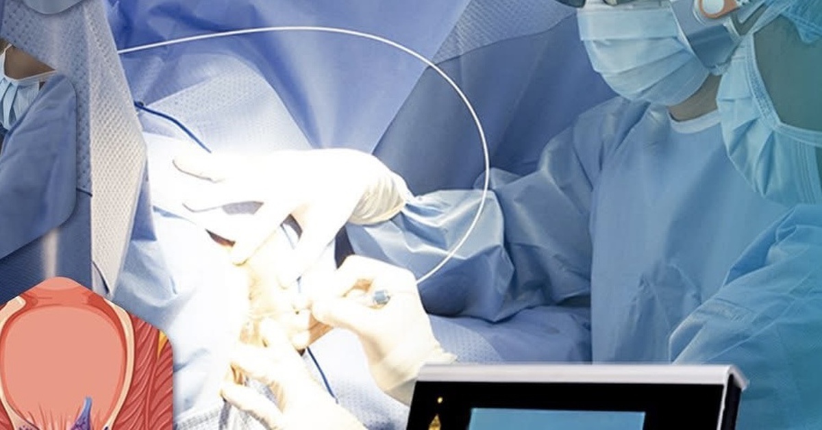 'Ôm' điện thoại quá lâu khi đi vệ sinh làm tăng nguy cơ bệnh trĩ