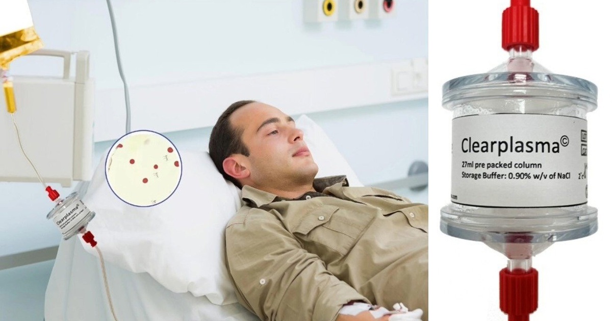 Thiết bị lọc huyết tương giúp ngăn tình trạng xuất huyết cấp tính